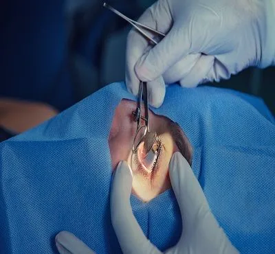 Eye Surgery Malpractice Cases